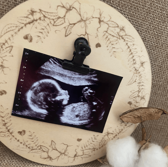 Carte échographie en bois - Cadre photo echographie